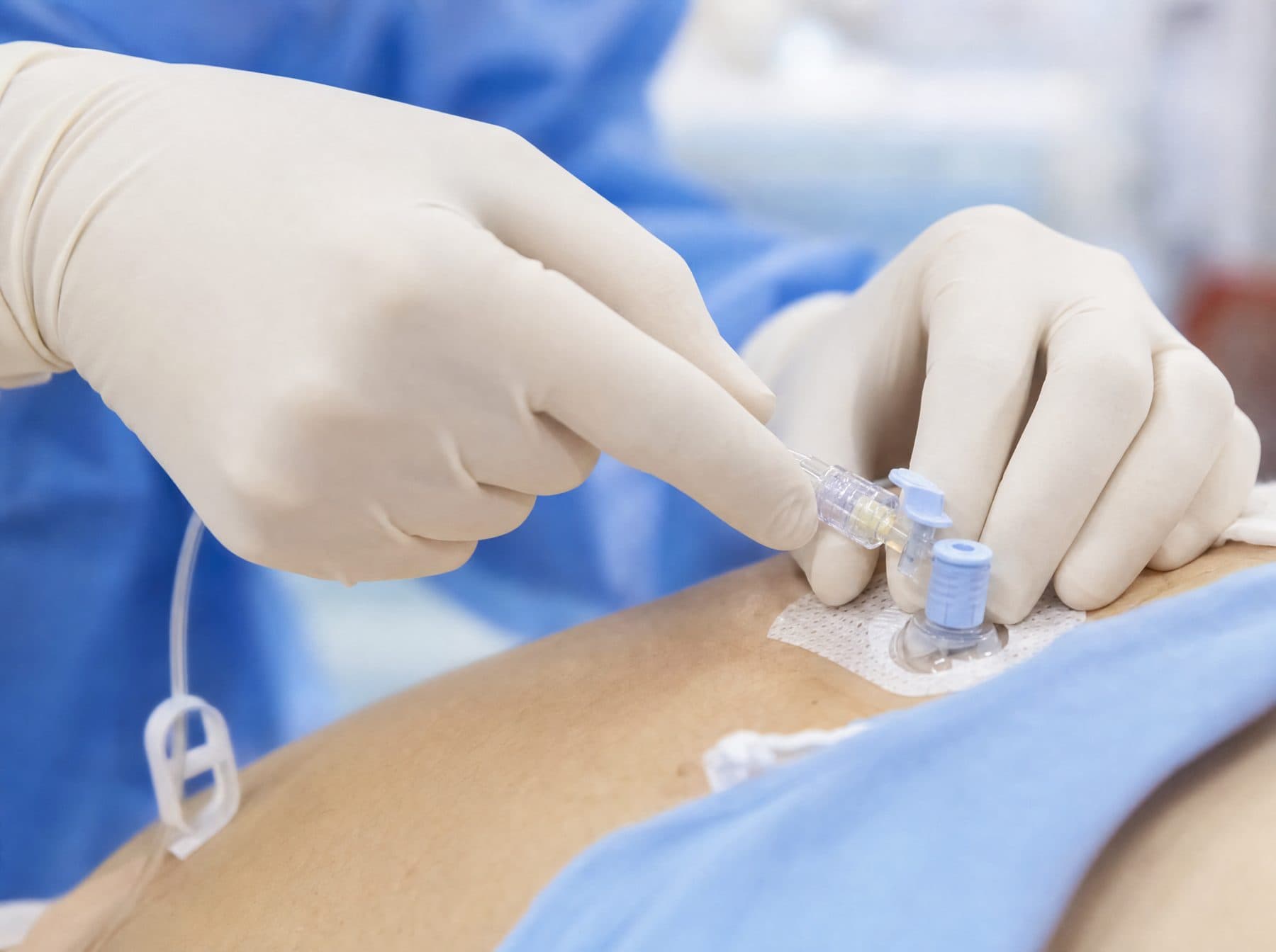 Gloved nurse hands connecting an IV line in a bright clinical room